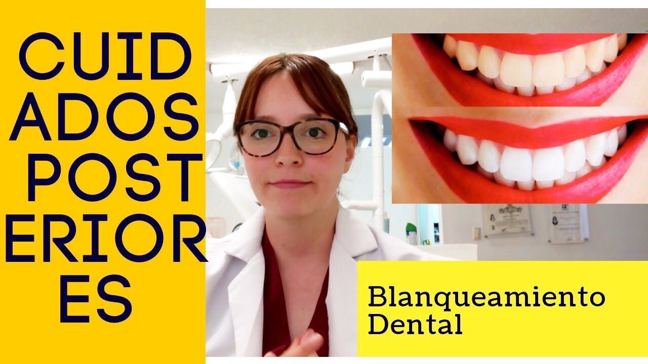 Cuidados Posteriores al BLANQUEAMIENTO DENTAL