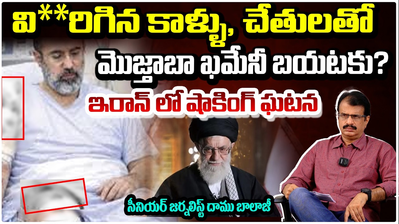 వి**రిగిన కాళ్ళు, చేతులతో మొజ్తాబా ఖమేనీ బయటకు? Mojtaba Khamenei Seriously Injured? Iran War Update