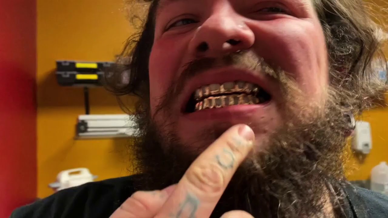14k 10on10 Openface!!! Yellow Gold!!! Georgiagoldgrillzz Gold Grill
