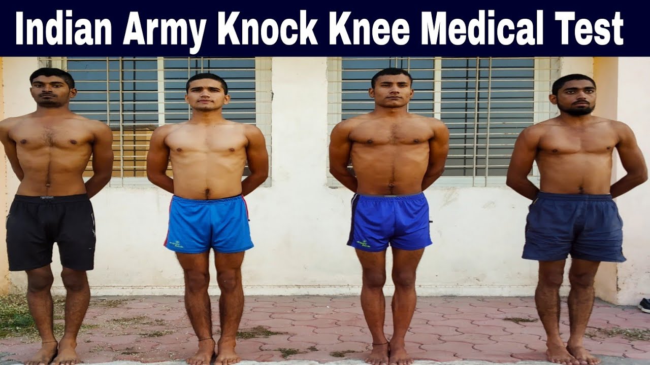 Knock Knee Medical Test nd Exercises | घूटने के दोष से छुटकारा