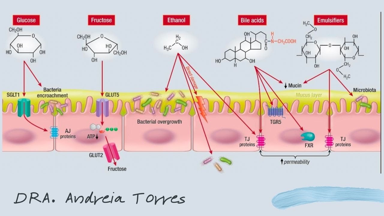 FATORES DIETÉTICOS QUE INFLUENCIAM A PERMEABILIDADE INTESTINAL | APRENDA NUTRIÇÃO