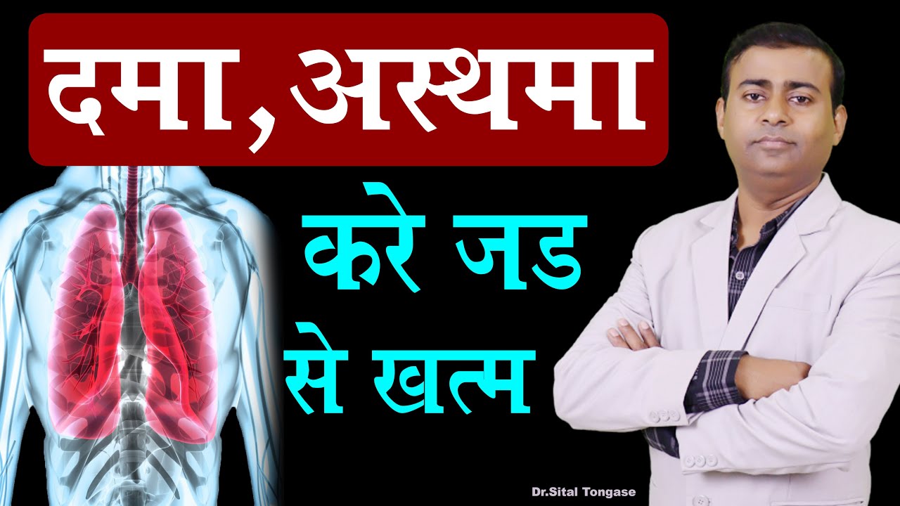 दमा,अस्थमा (Asthma) करे जड़ से खत्म करें | Asthma treatment in Hindi
