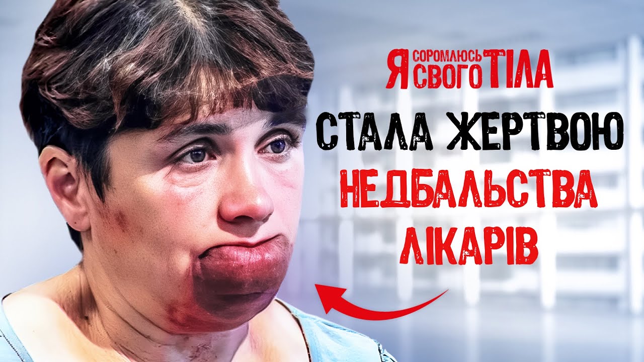 Последствия халатности во время родов – Я соромлюсь свого тіла | МЕДИЦИНА | ВРАЧИ | ЗДОРОВЬЕ