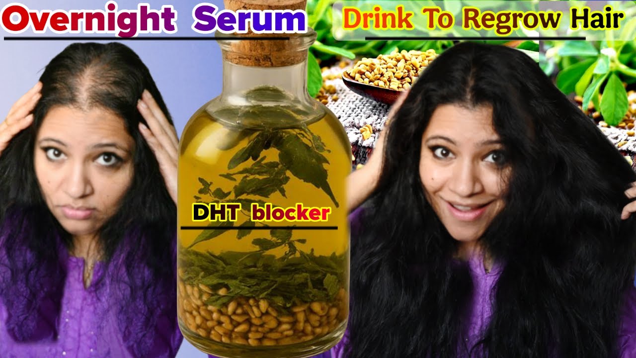 Just Use This Overnight Serum To Block DHT & To Regrow Lost Hair Naturally ।Garima Singh ।