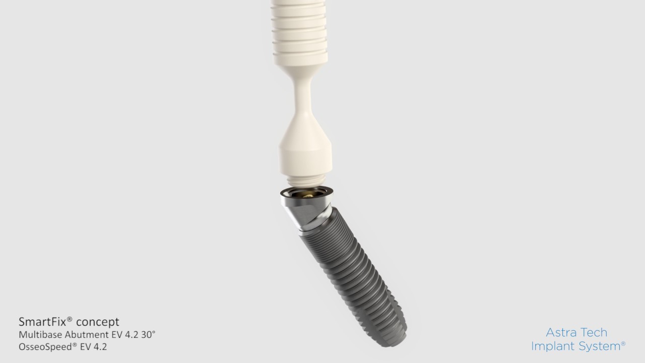 SmartFix concept Astra Tech Implant System EV- Multibase Abutment EV 30  | Dentsply Sirona