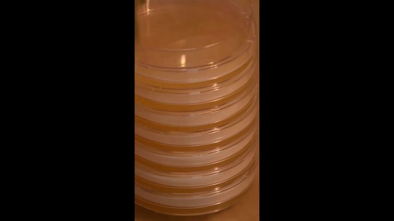 Agar series video 2   managing condensation