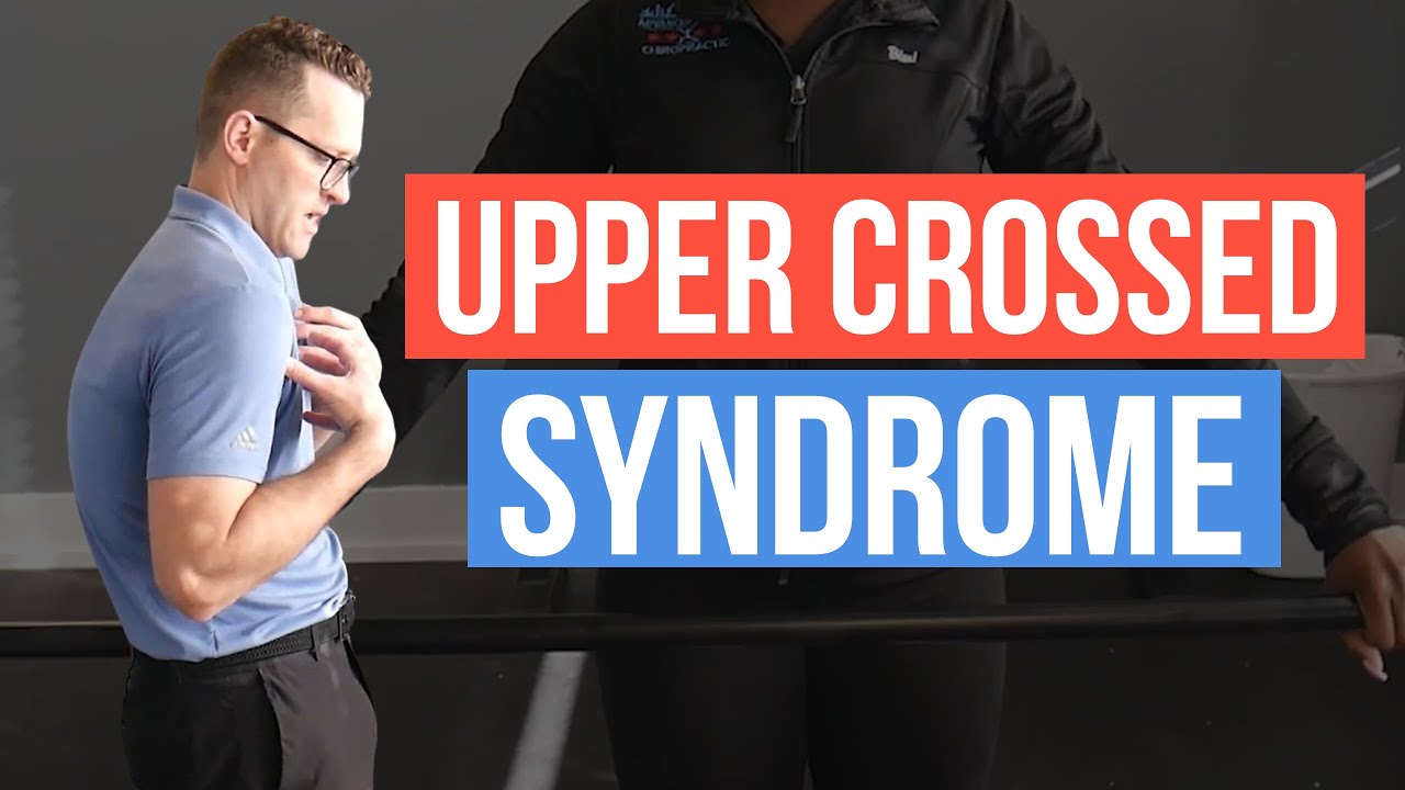 Upper Crossed Syndrome Explained