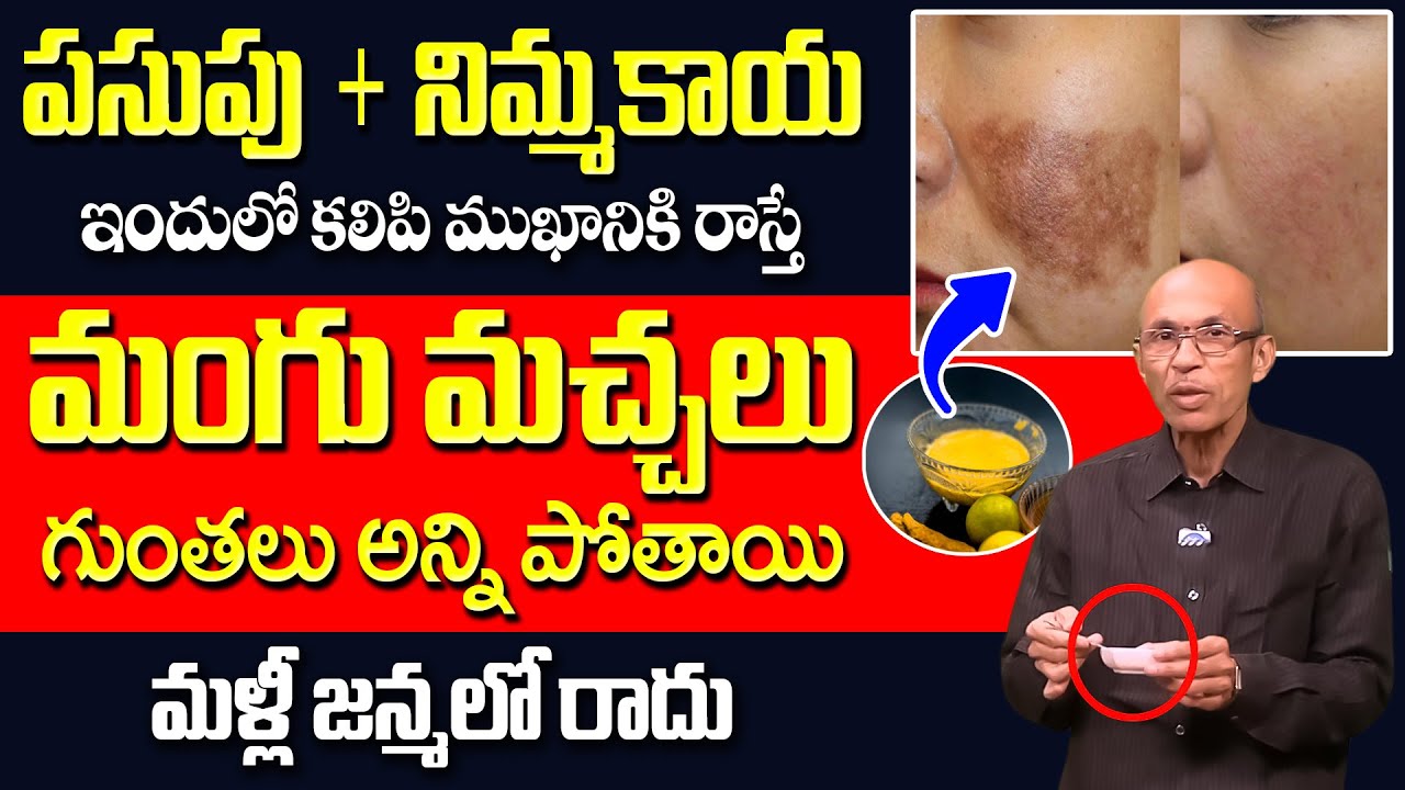 10 రోజుల్లో మీ పిగ్మెంటేషన్ కి, నల్ల మచ్చలు అన్ని మాయం | Remove Pigmentation | Dr Madhusudana Sarma