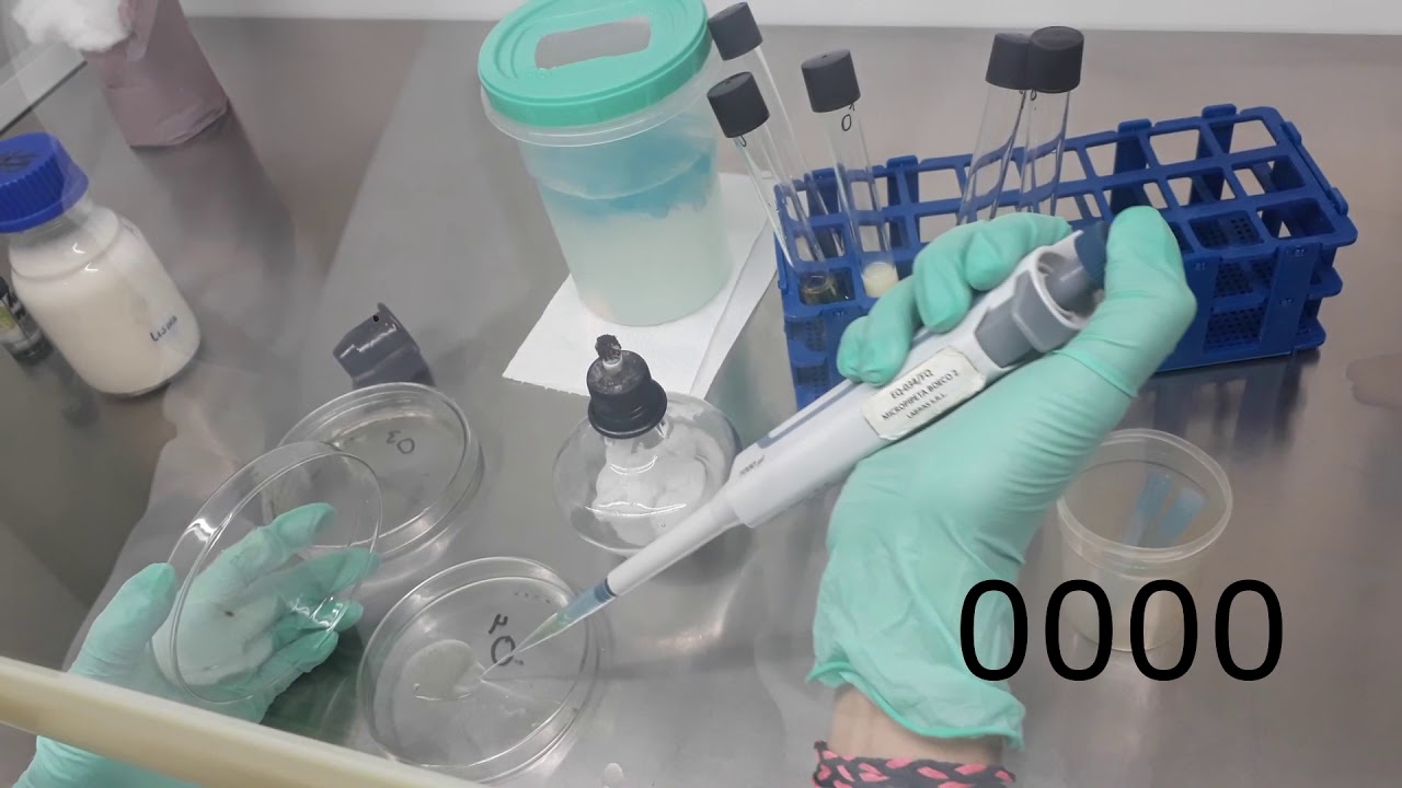 Análisis Microbiológico de la Leche