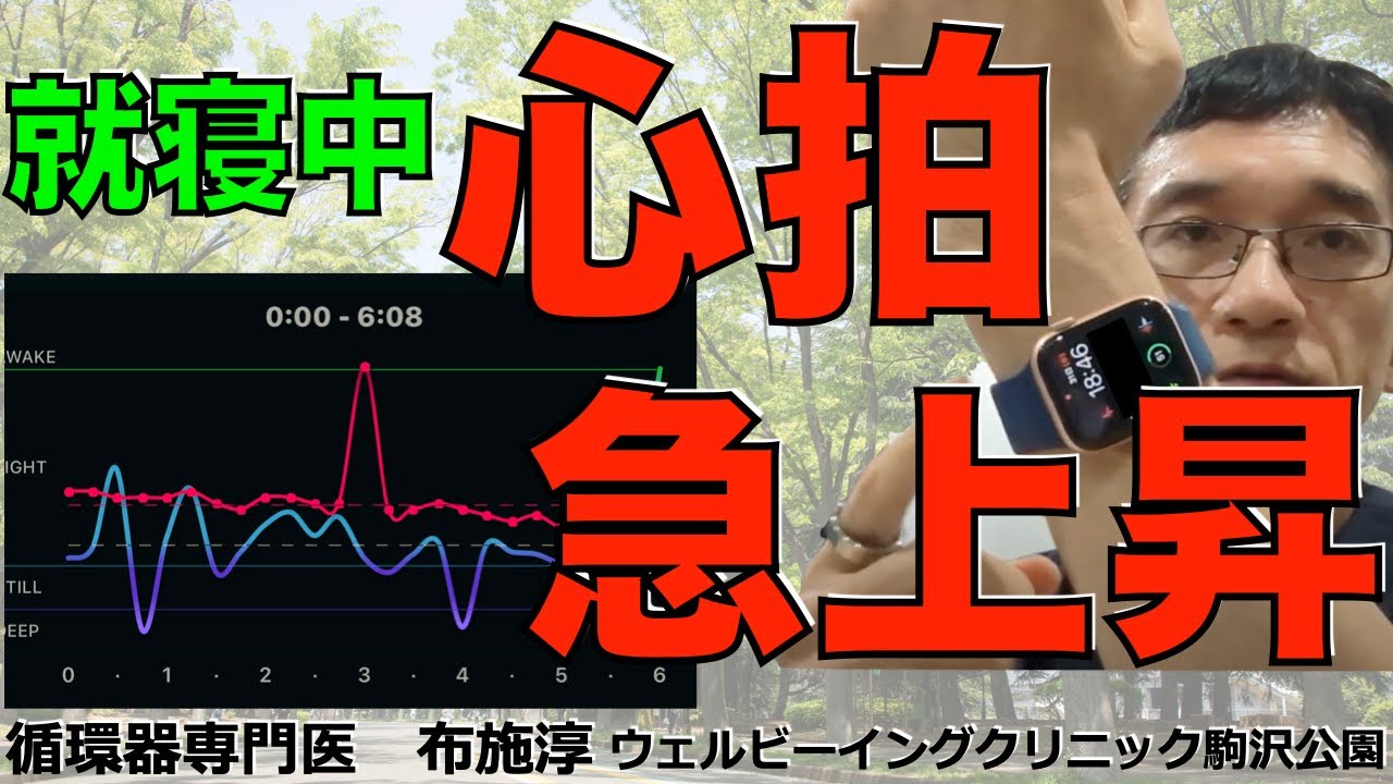 【質問】スマートウォッチで睡眠中の心拍数が急上昇！何が考えられるでしょうか？　#頻脈　＃心房細動
