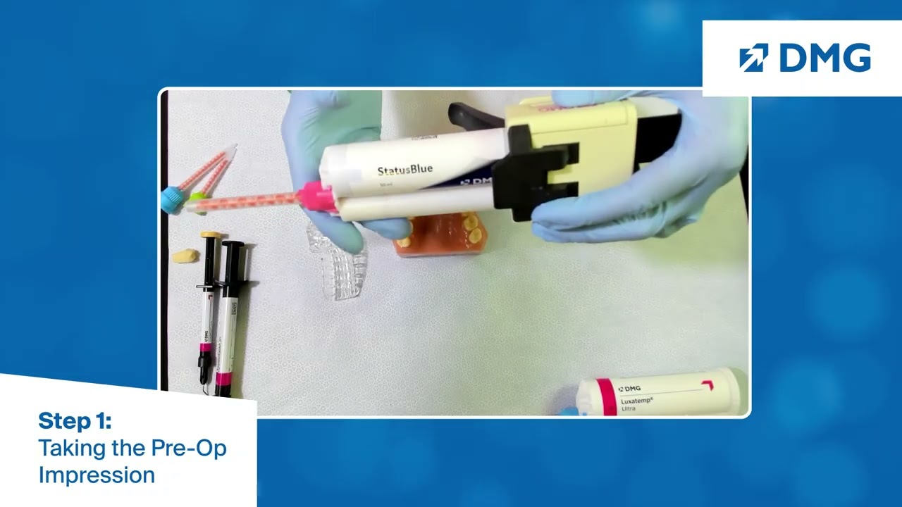 Clinical Provisional Crown and Bridge Workflow: Step 1, Taking the Impression