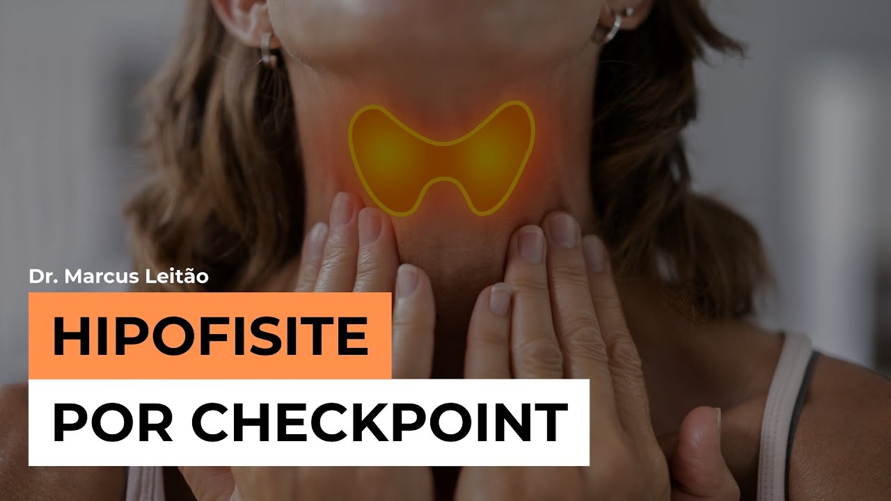Case Hipofisite por Checkpoint | Marcus Leitão | Endocrinologia descomplicada