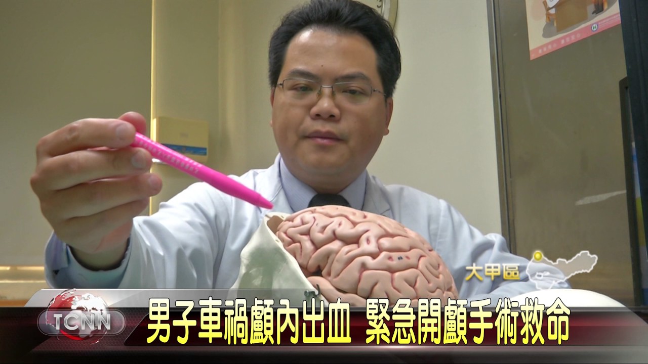 大台中新聞-男子車禍顱內出血 緊急開顱手術救命