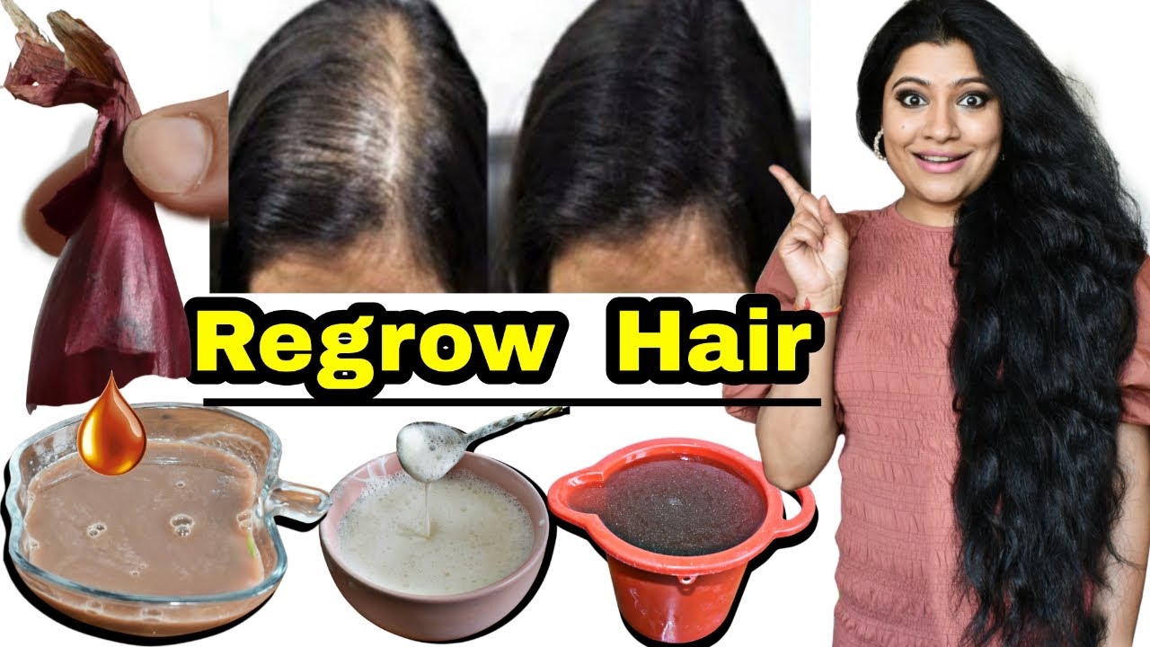 3 Steps To Regrow Lost Hair: Increase Thickness, Volume, Density Of Hair बालों को वापस उगायें