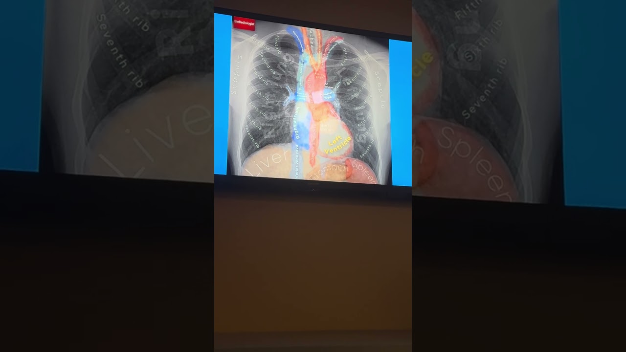 Dr Alam presents Understanding Radiological Exams