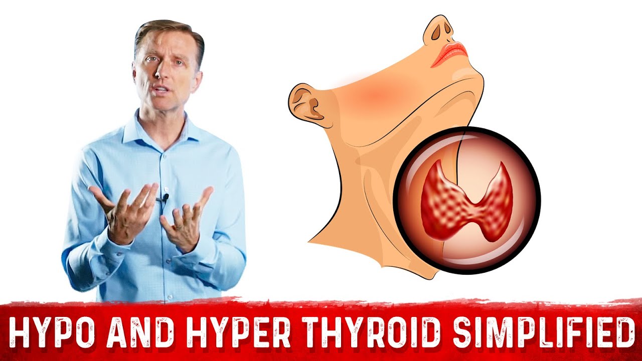 Hyperthyroid vs Hypothyroid Explained By Dr. Berg