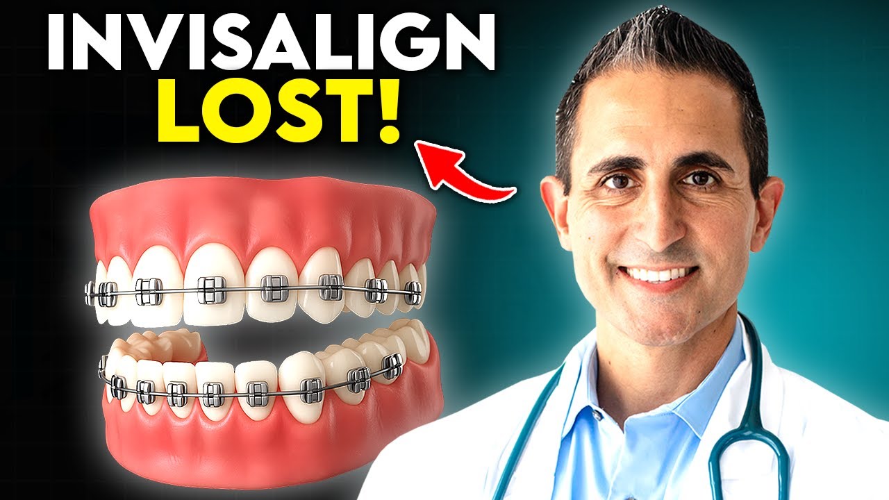 Why Metal Braces Are Best in 2025 (And Beating Invisalign)