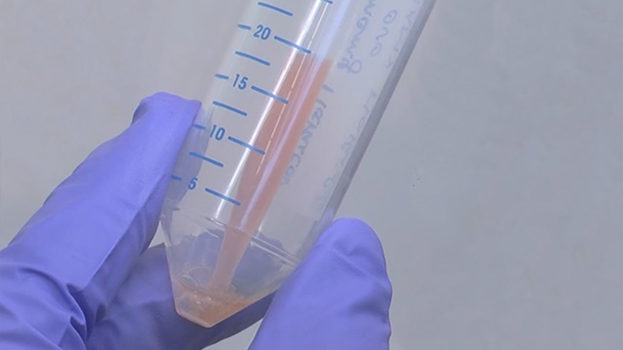 Les HAP, un potentiel effet sur la fertilité ?