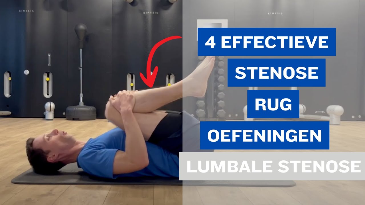 4 Effectieve Stenose Rug Oefeningen bij een Lumbale Stenose 🤕😇