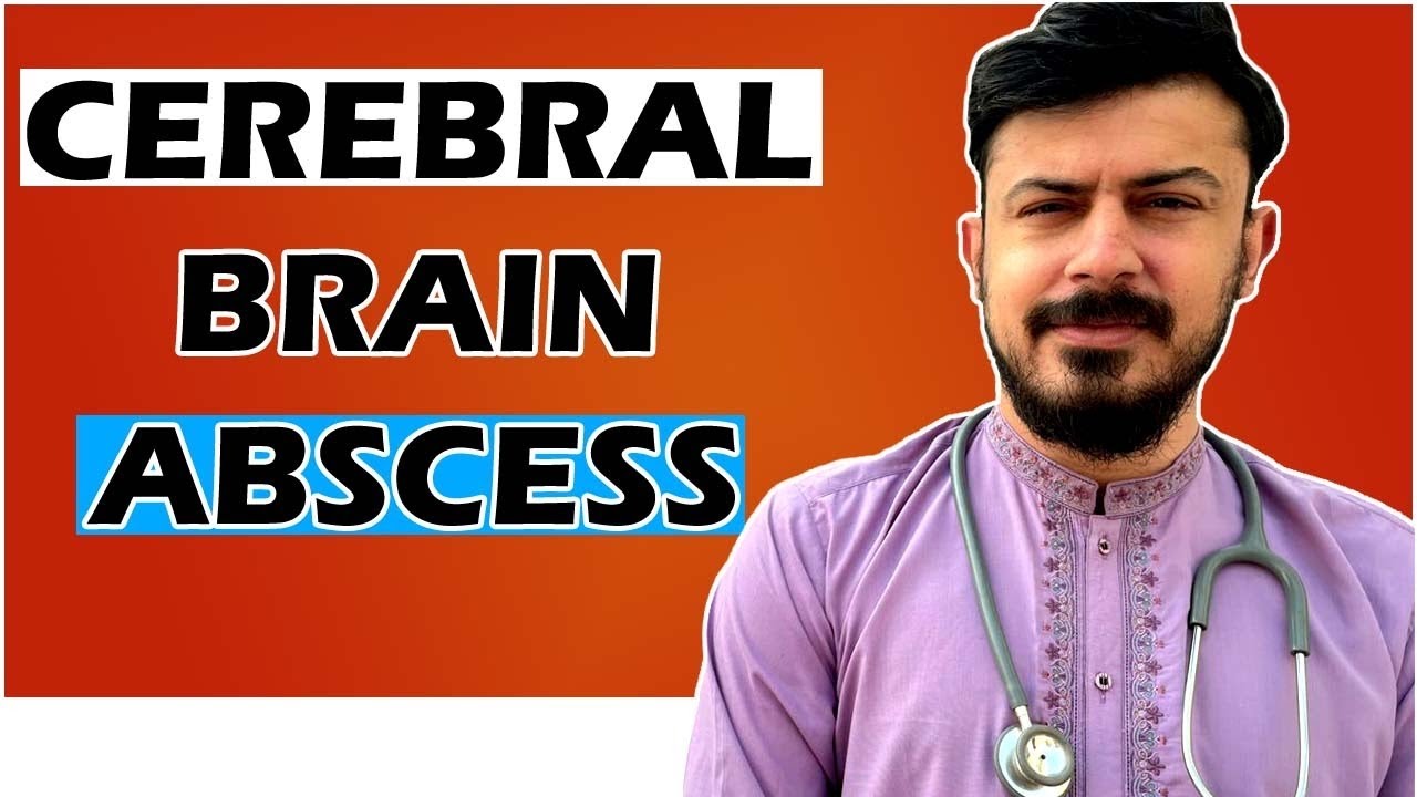 Cerebral/Brain Abscess Symptoms,Spread,Diagnosis and Treatment | Infectious Medicines