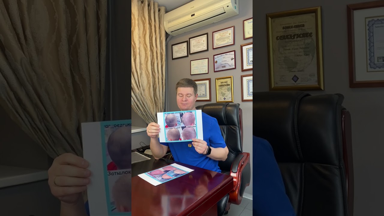 Восстанавливается донорская зона после пересадки ?