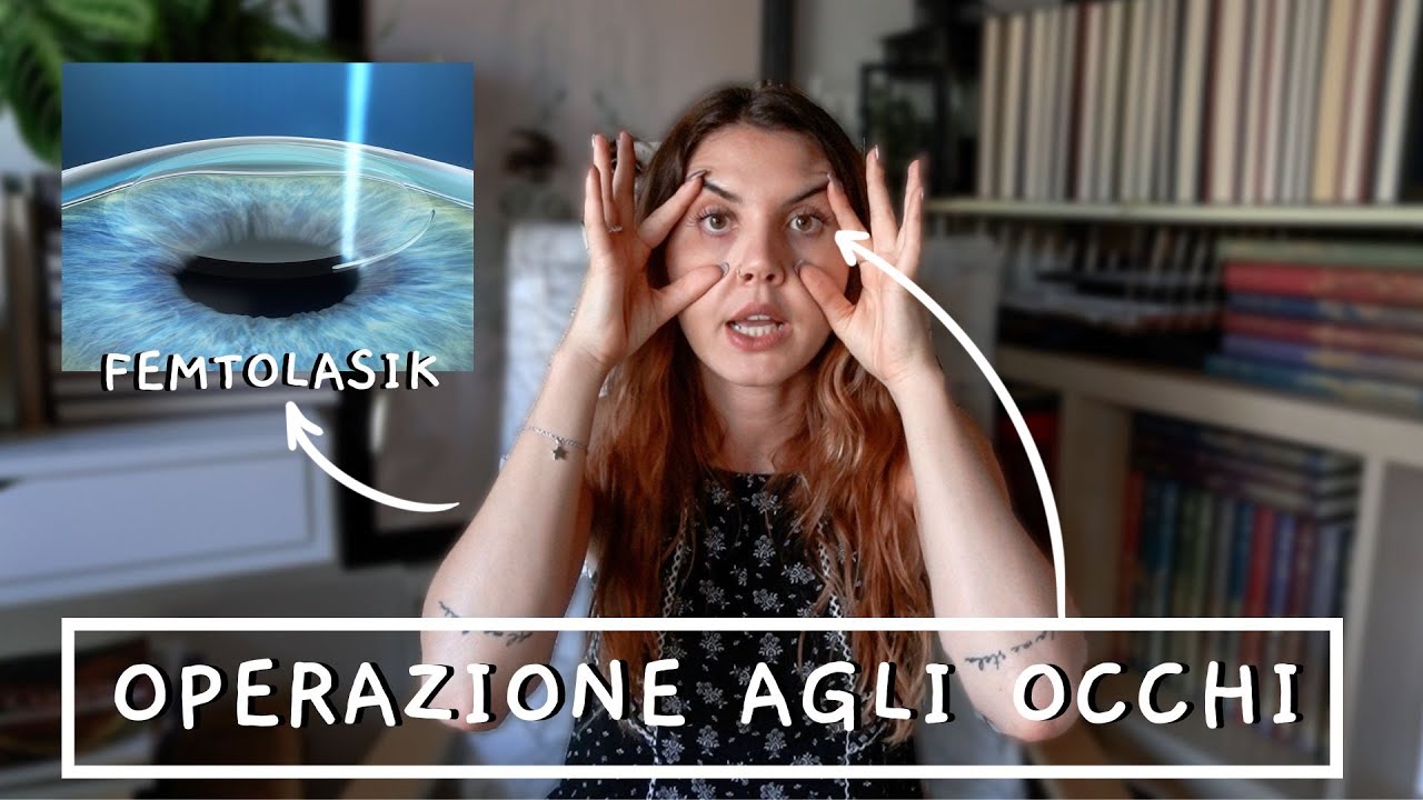 L'OPERAZIONE CHE MI HA CAMBIATO LA VITA!!! - Laser occhi FEMTOLASIK 😎