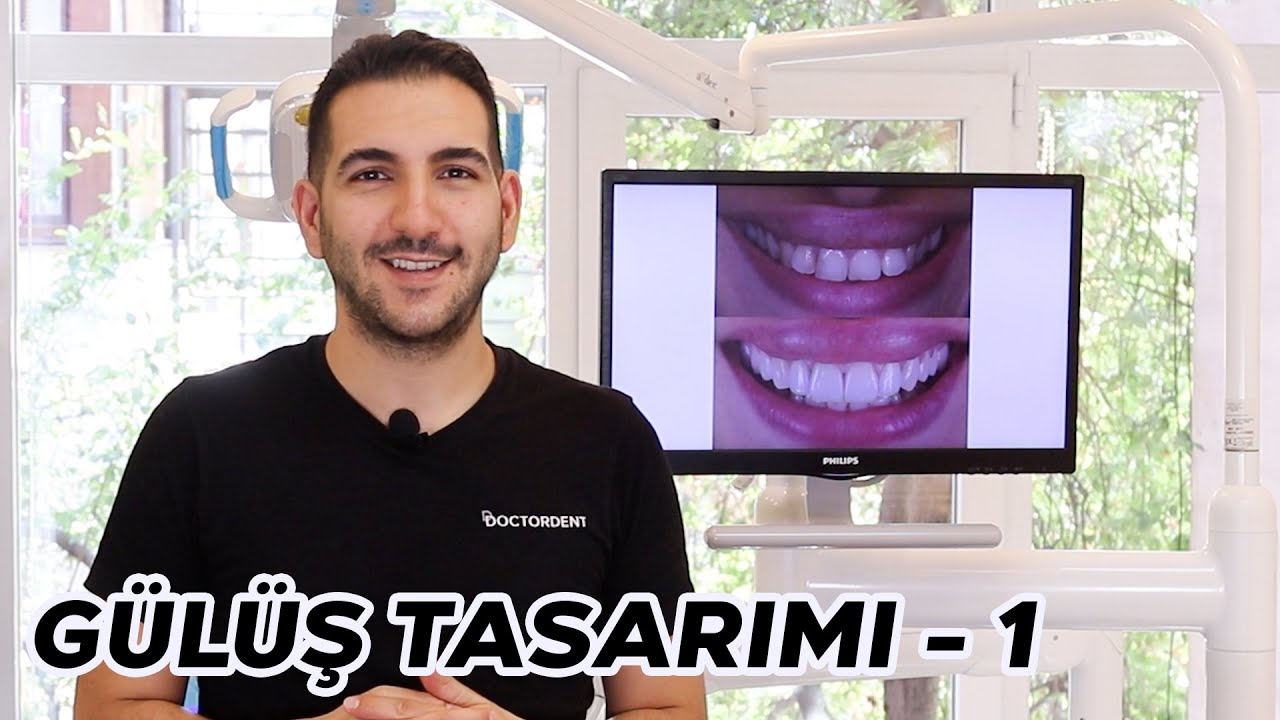 Gülüş Tasarımı Nasıl yapılır? Vaka İnceleme | DOCTORDENT