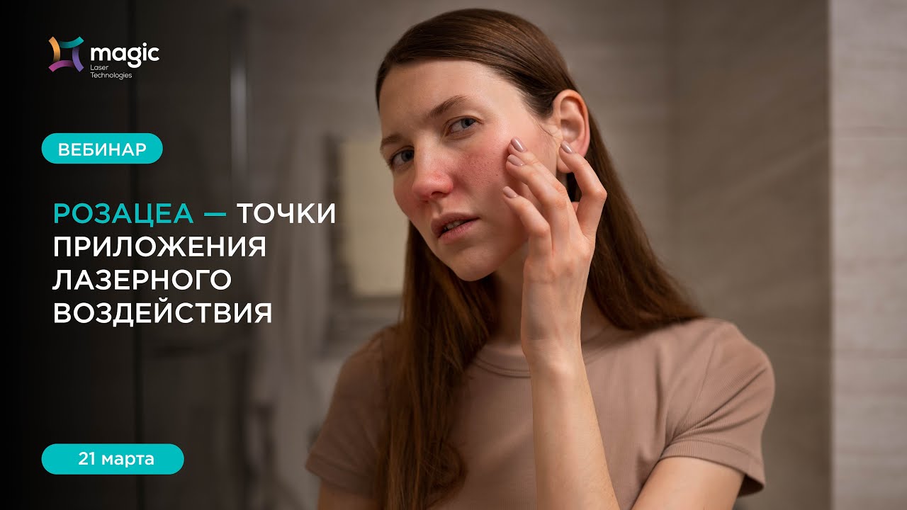 Розацеа: точки приложение лазерного воздействия