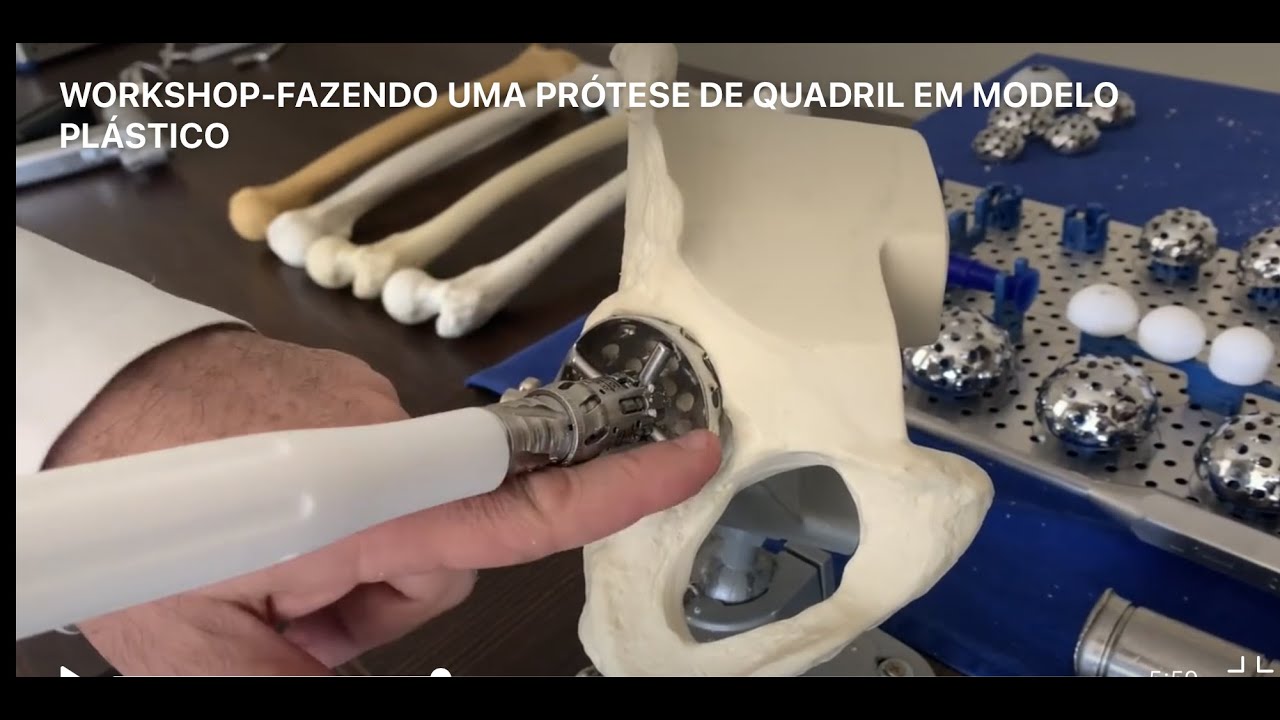 WORKSHOP- FAZENDO UMA PRÓTESE DO QUADRIL EM MODELO PLÁSTICO
