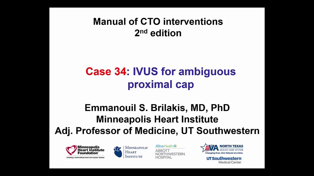 Case 34: Manual of CTO Interventions - IVUS for proximal cap ambiguity