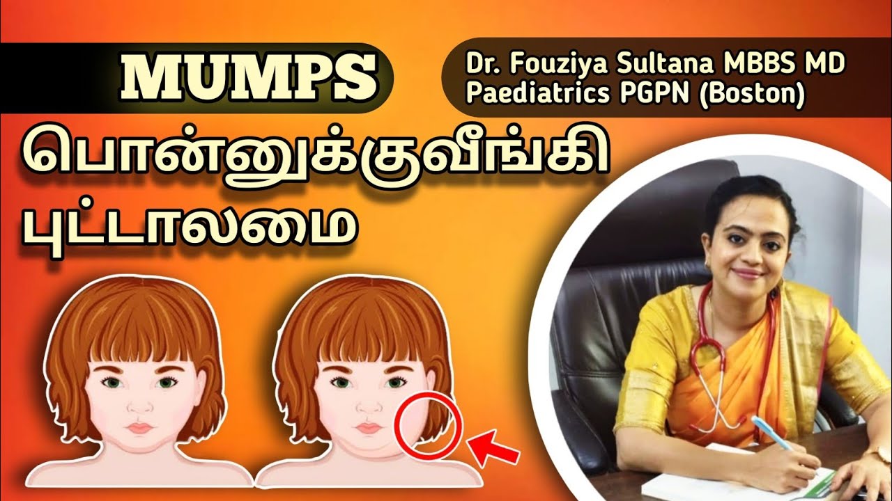 Mumps (பொன்னுக்கு வீங்கி, புட்டாலம்மை) by Dr. Fouziya Sultana MBBS MD Paediatrics PGPN (Boston)