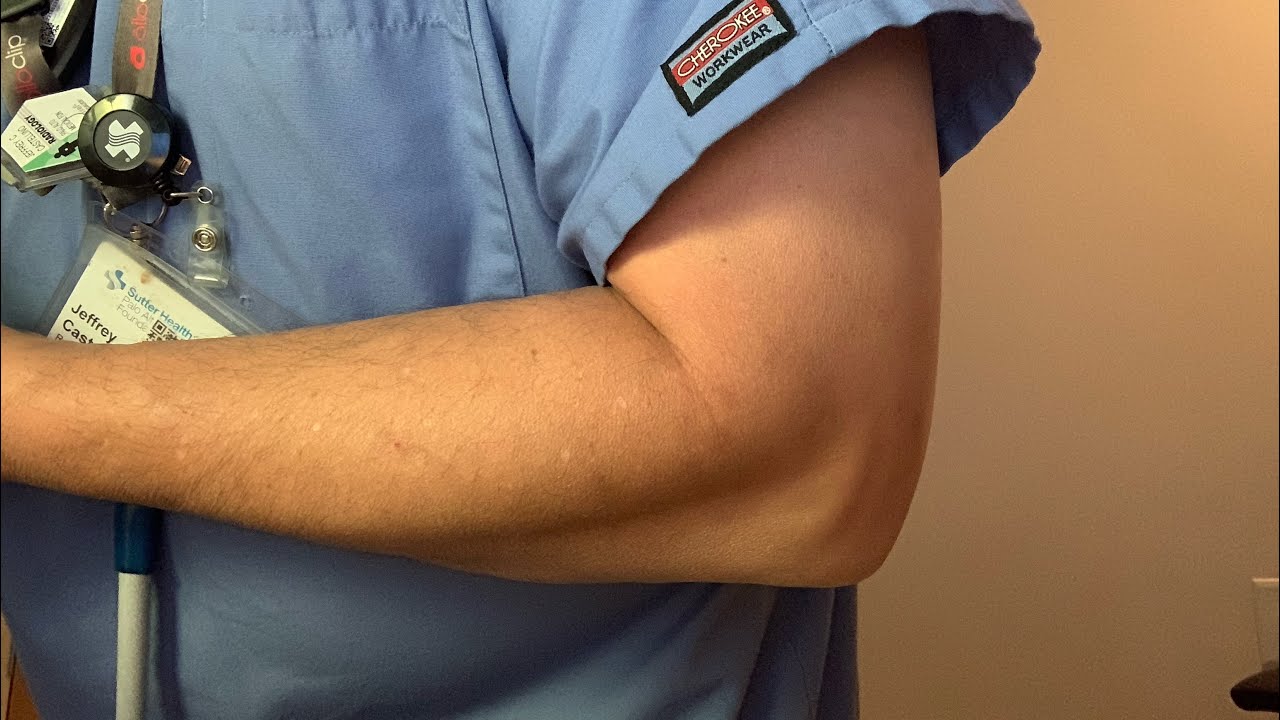 HowTo Take A Upright Trauma (Flexed) Elbow X-Ray Series Perfectly - Every Time!!!