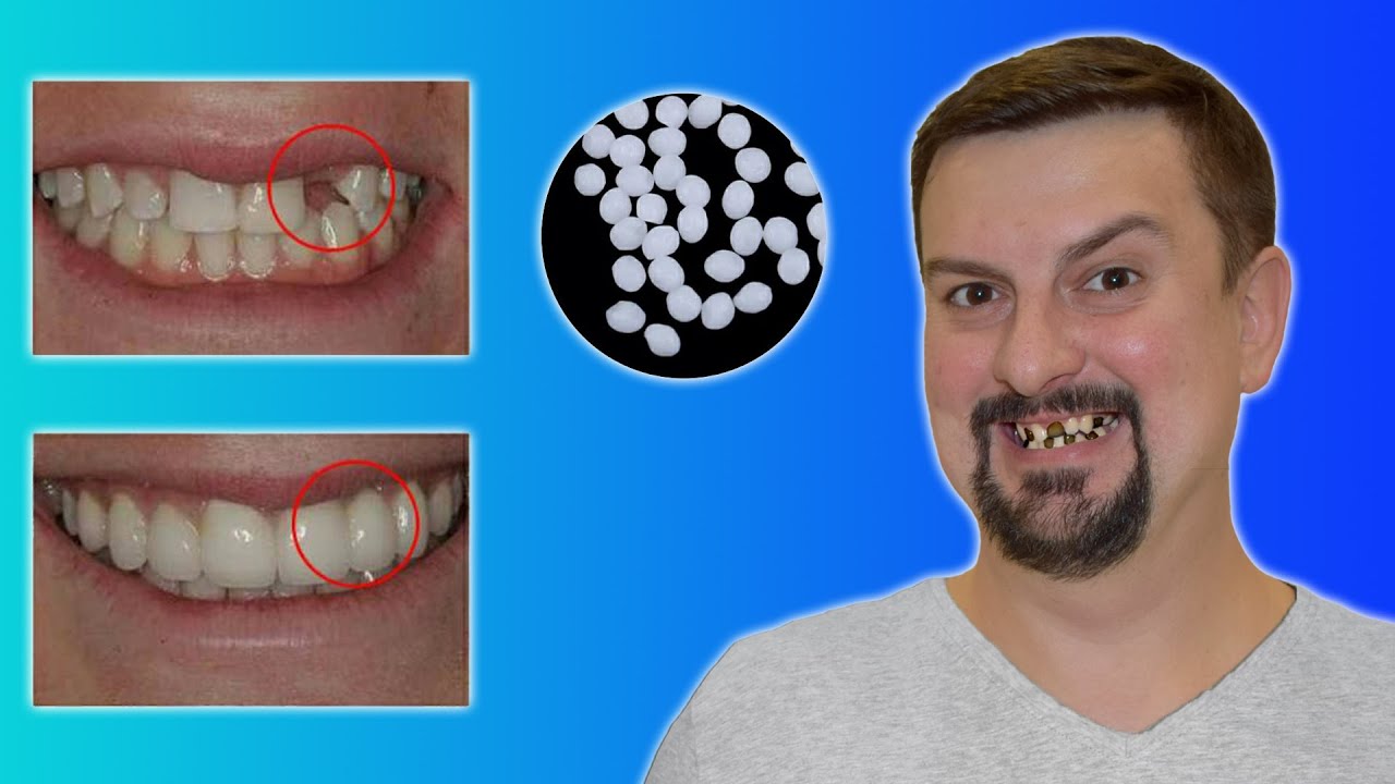 Новинка  -  круче чем китайские СЪЕМНЫЕ ВИНИРЫ для зубов Тестирую товары с joom ПРОВЕРКА РЕКЛАМЫ