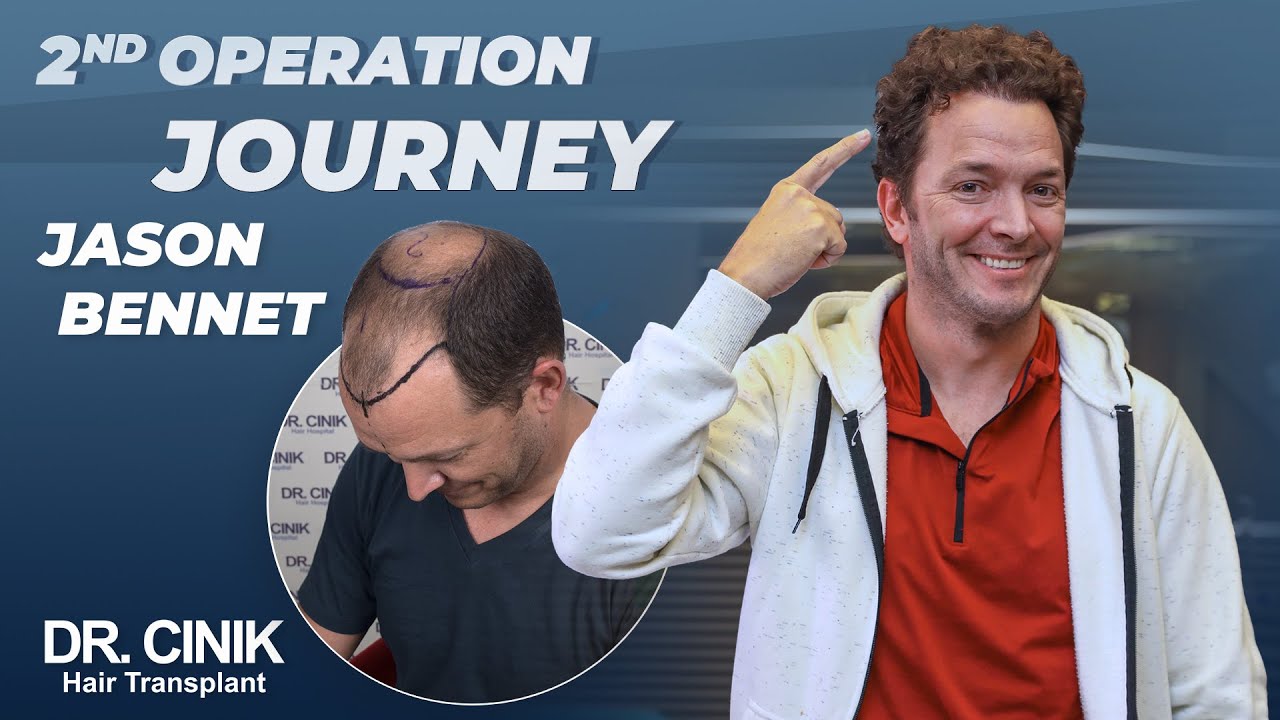 Jason Bennet 2nd Operation Journey