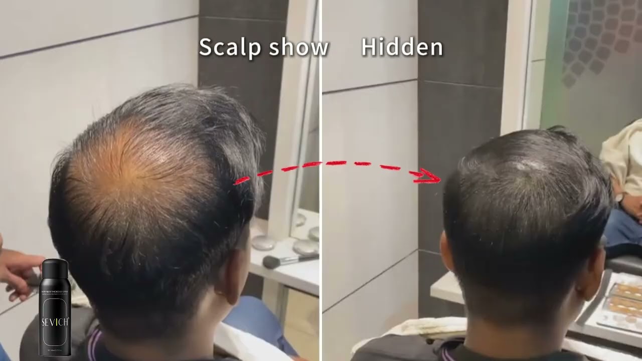 Hair Fiber Thickener Spray #sevich #hair #spray #hairspray #haircolor
