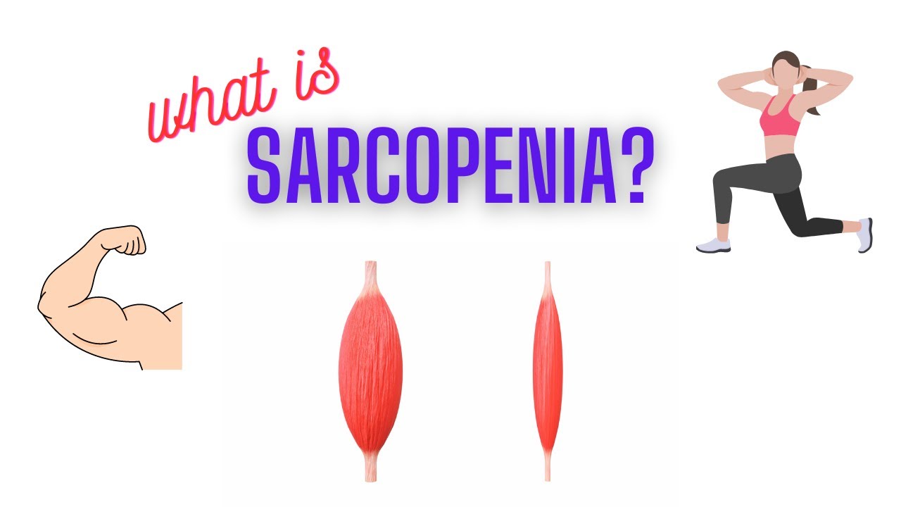 What is SARCOPENIA?