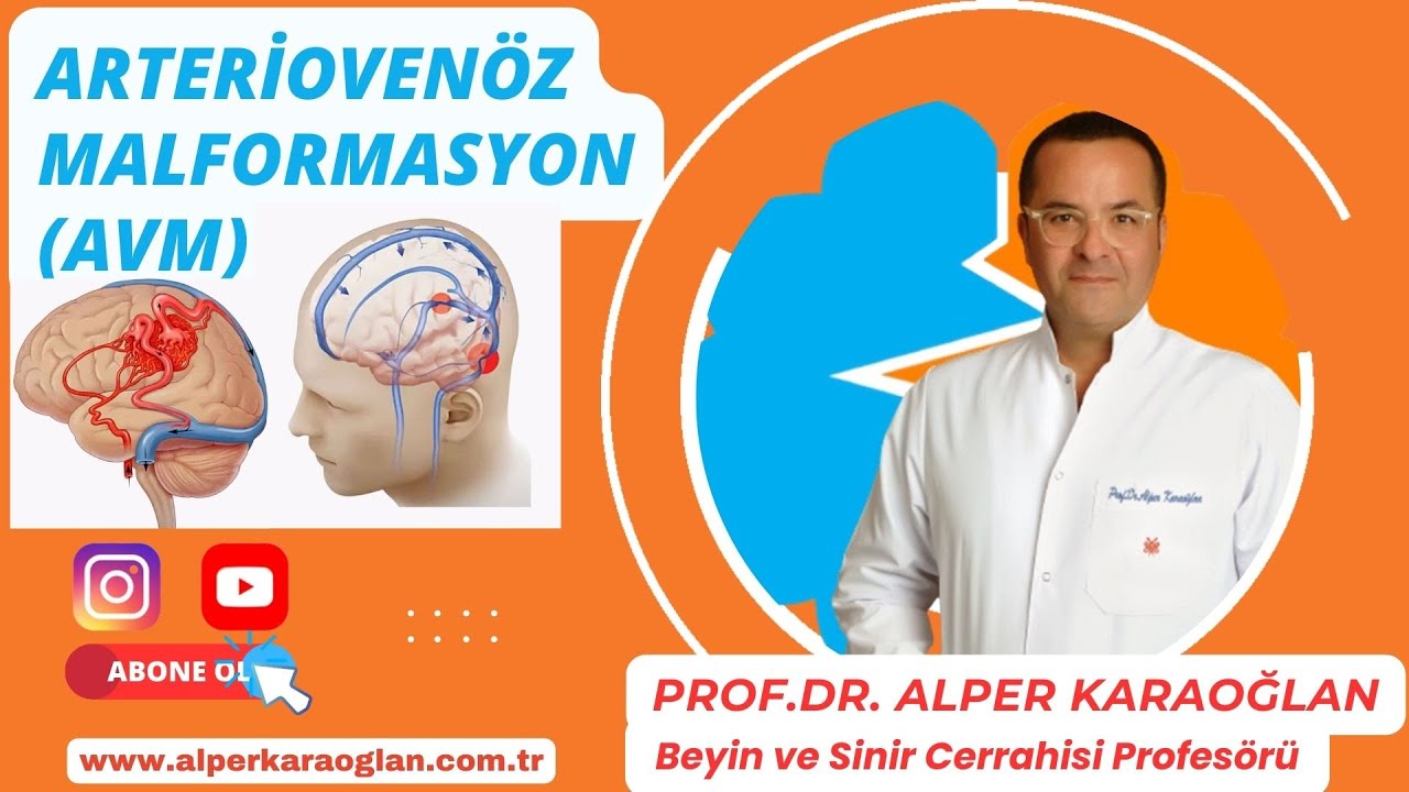 Что такое артериовенозная мальформация (АВМ)? | Проф. Др. Альпер КАРАОГЛАН