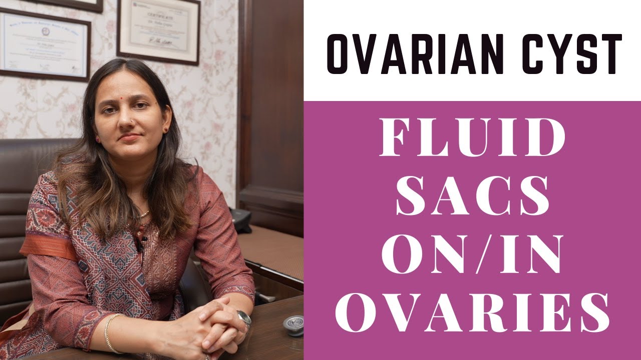 Ovarian Cyst | Femi Nine by Dr. Neha Gupta