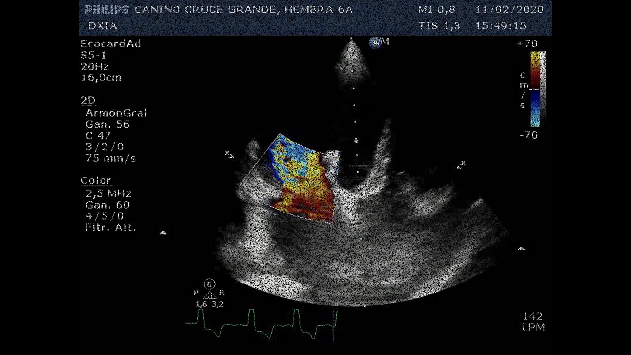 Rita EcoAbdominal DXIA