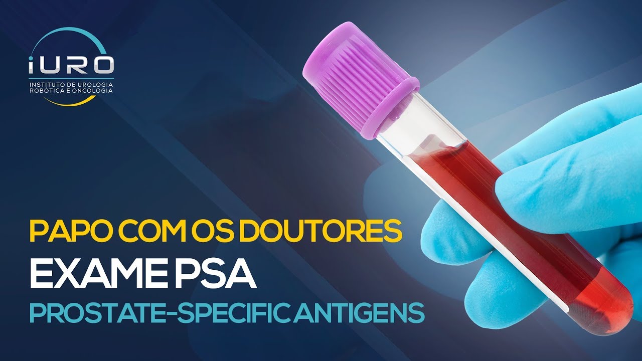 O que &eacute; PSA ? PSA alto? Entenda a import&acirc;ncia do EXAME PSA