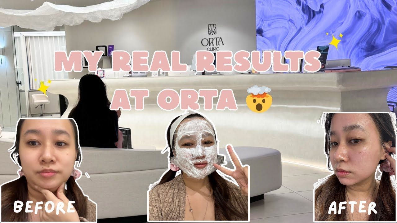 Мой честный отзыв о клинике ORTA в Сеуле 🇰🇷 | Опыт лечения кожи в Корее (НЕ спонсированный!)