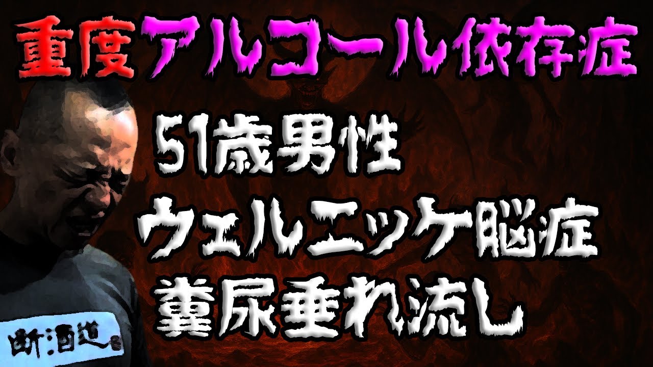 【断酒】51歳重度アルコール依存症 ウェルニッケ・おむつ壮絶人生～永久保存版～