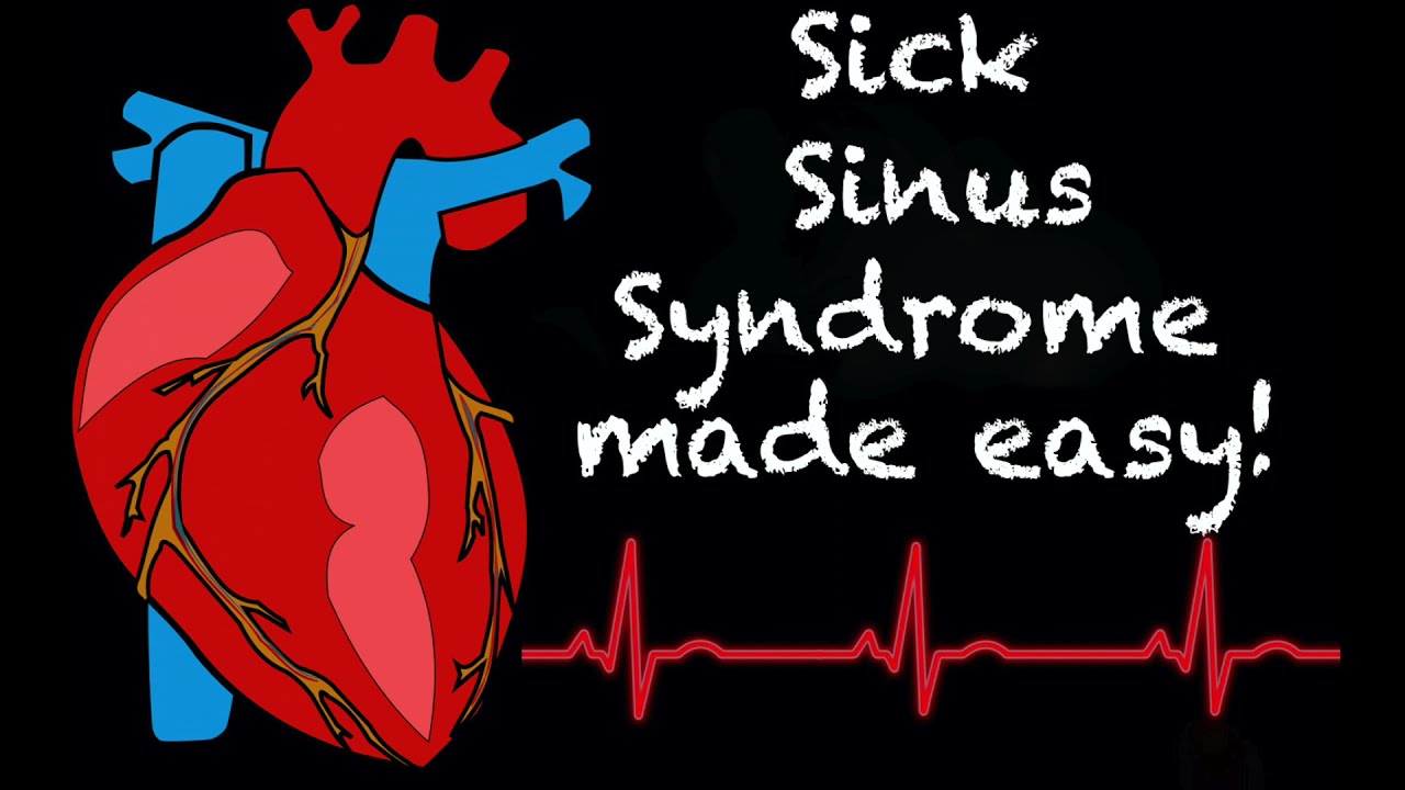 EMS Cardiology || Tachy Tuesday: Sick Sinus Syndrome in EMS