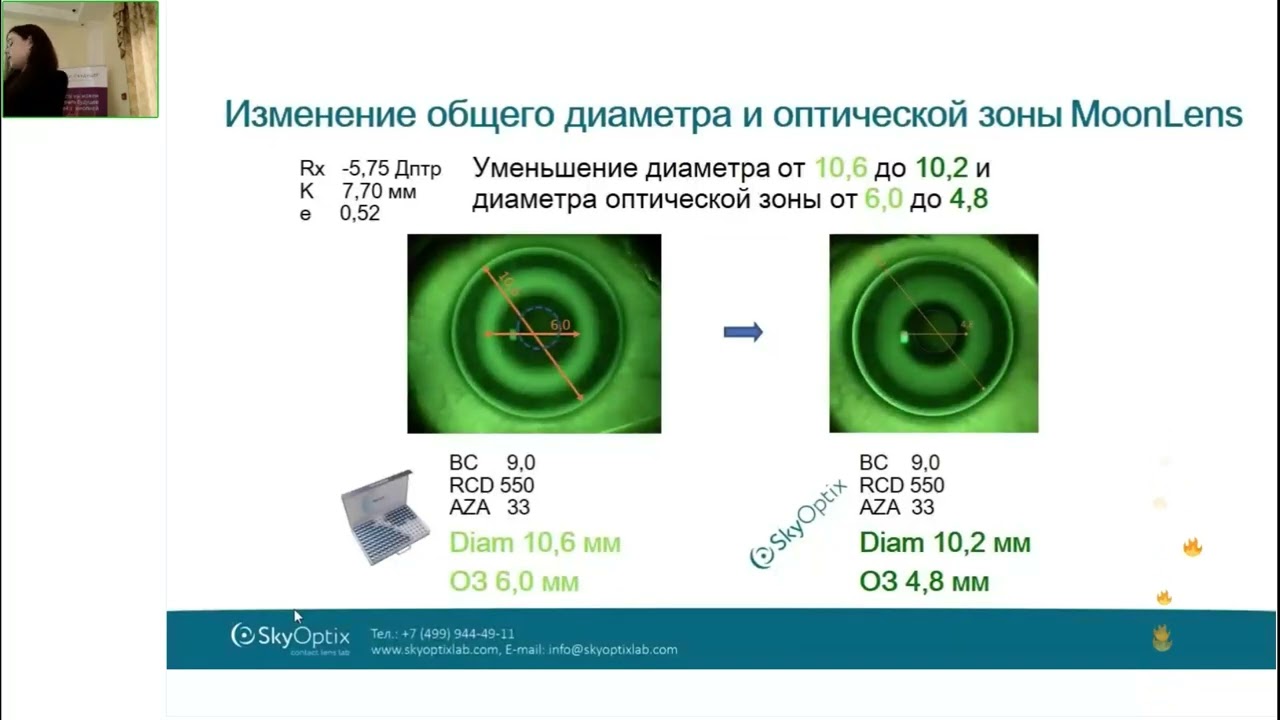 Оптометрический форум 2024: Глущенко Е.А. «Пять шагов к успеху ... с использованием линз MoonLens»