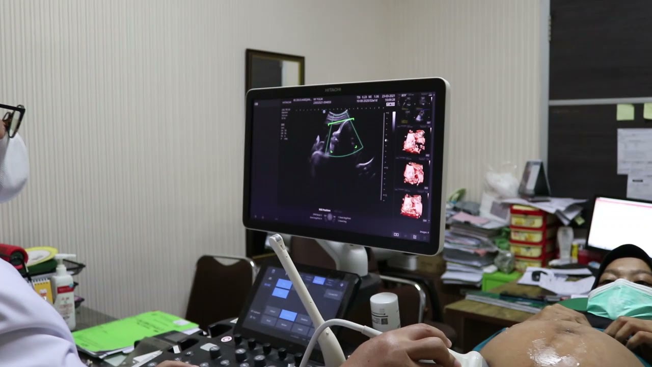Pemeriksaan kehamilan dengan USG 4D dan 3D  Rumah sakit TK II dr. R. Hardjanto