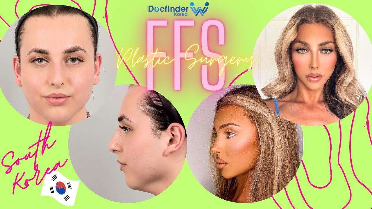You gotta watch this BEST Facial Feminization Surgery in Korea Part 1