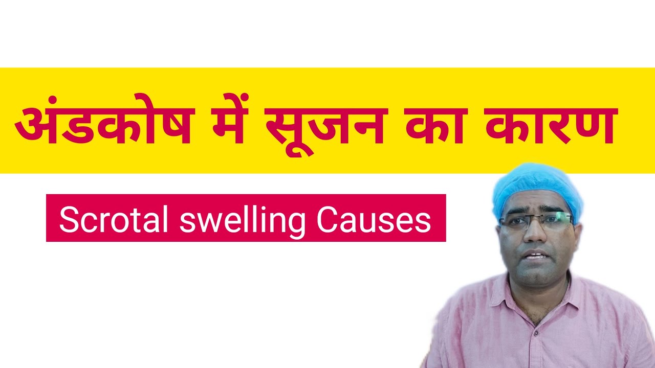 Scrotal (testicular) Swelling Causes Hindi| अंडाशय में सूजन का कारण | Andkosh Me Sujan Kyun Hoti Hai