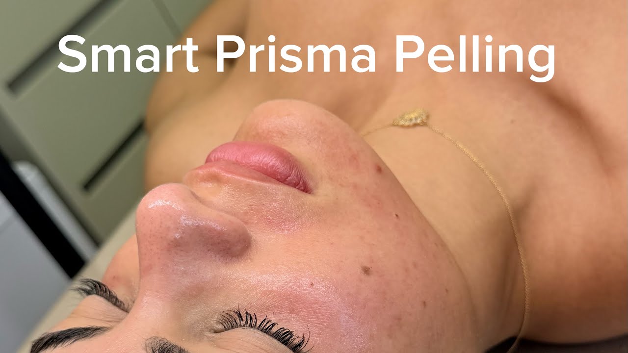 Passo a passo prisma pelling  smart 