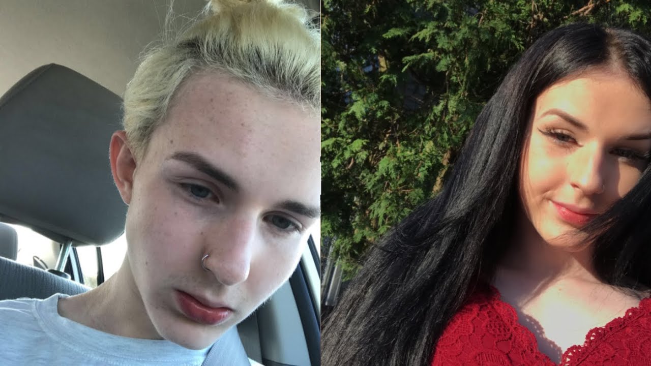 Transgender Transition Timeline - Male to Female (1 Year HRT)