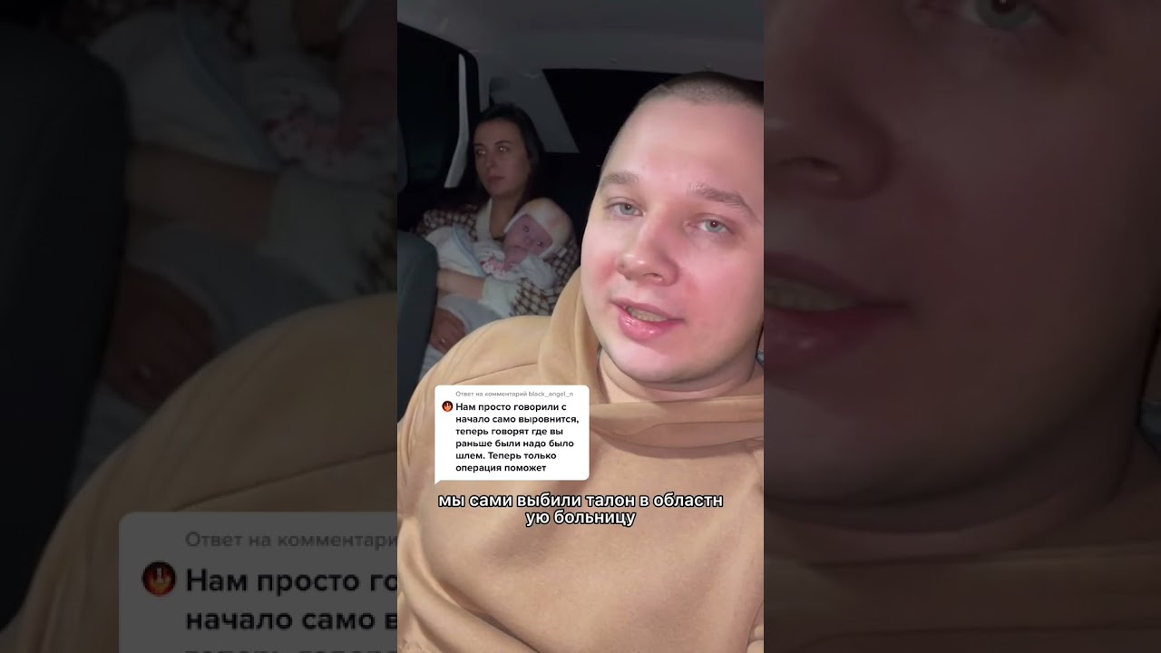 Шлем для исправления черепа наша история,ортопедический шлем,плагиоцефалия,остеопаты,педиатры